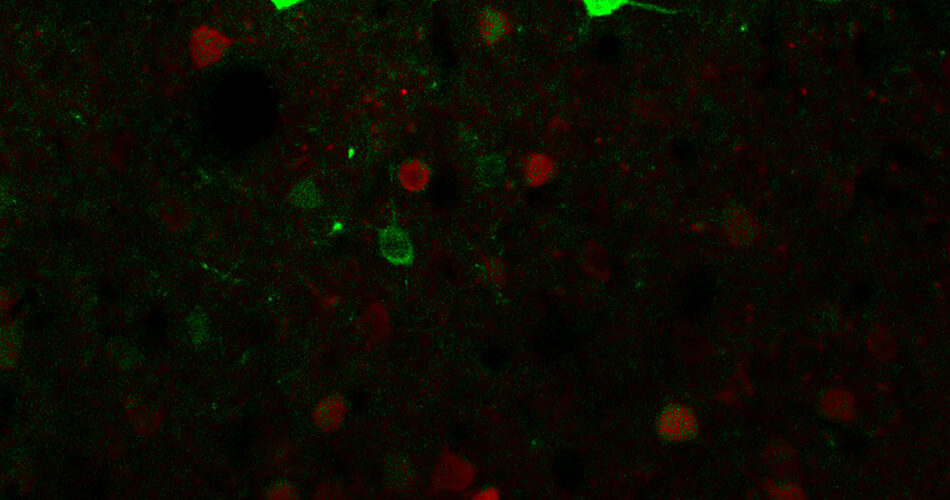 Ketamine And Obesity