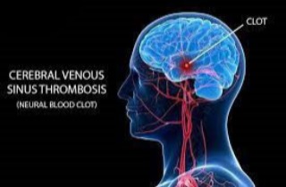 Obesity of Venous Channels