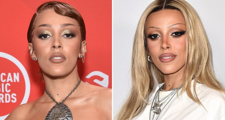 Doja Cat before And After Weight Loss 2024
